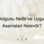 Diş Dolgusu Nedir Dolgu Nasil Yapilir - AEK Dent