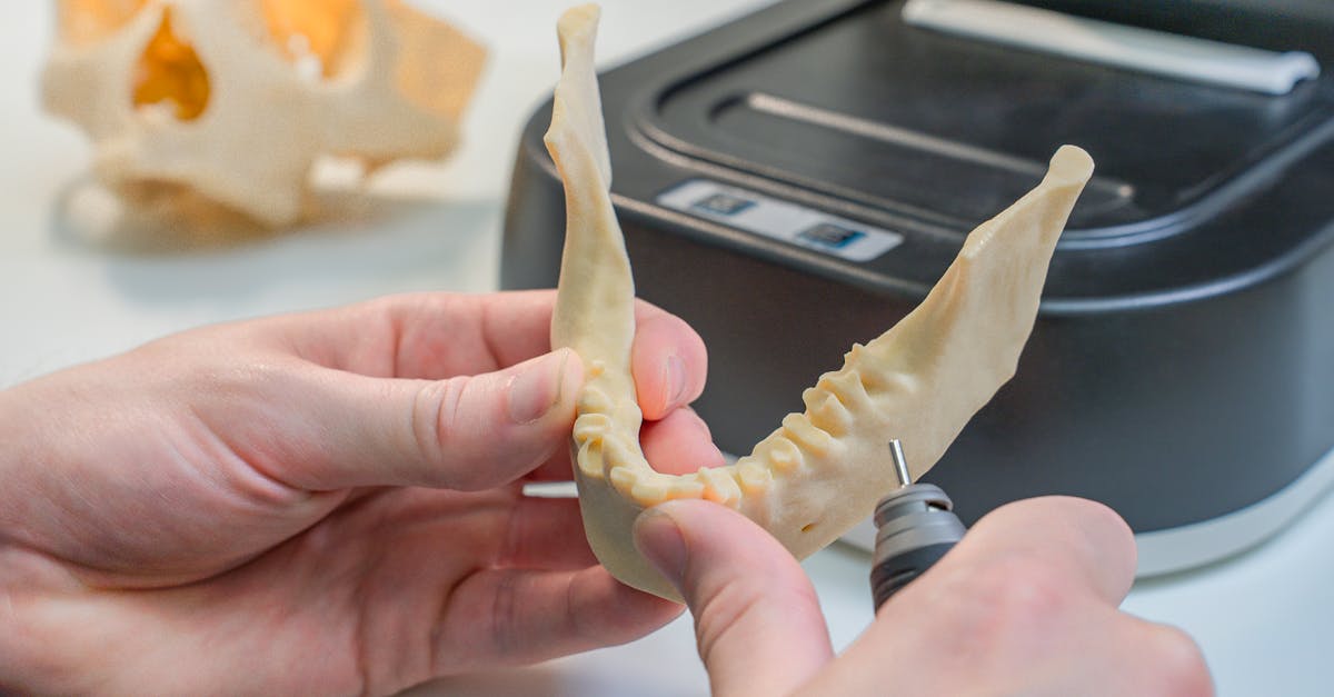 güneşli-implant-fiyatları-2026-647.jpeg