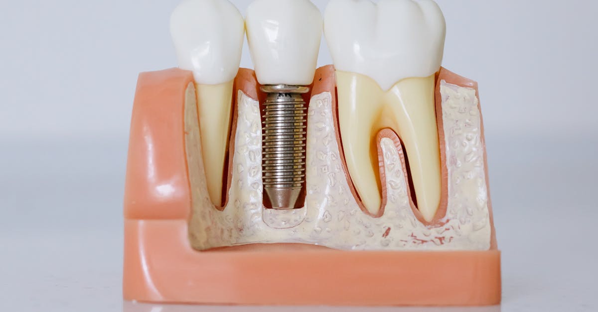 güneşli-implant-fiyatları-2026-955.jpeg