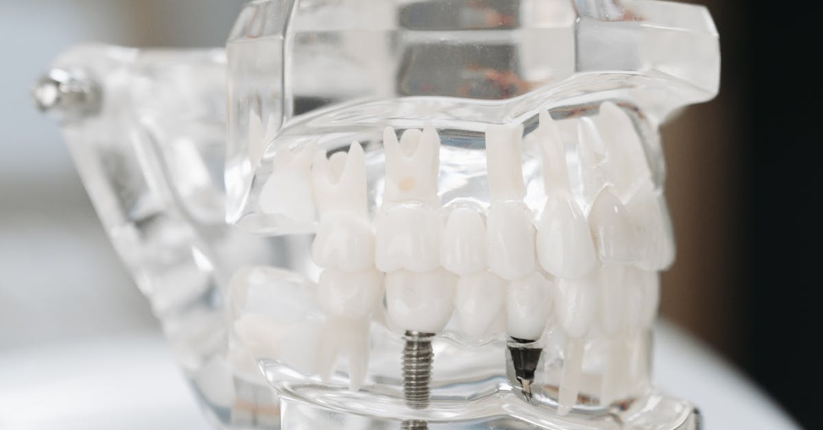 güneşli-implant-fiyatları-2026-674.jpeg