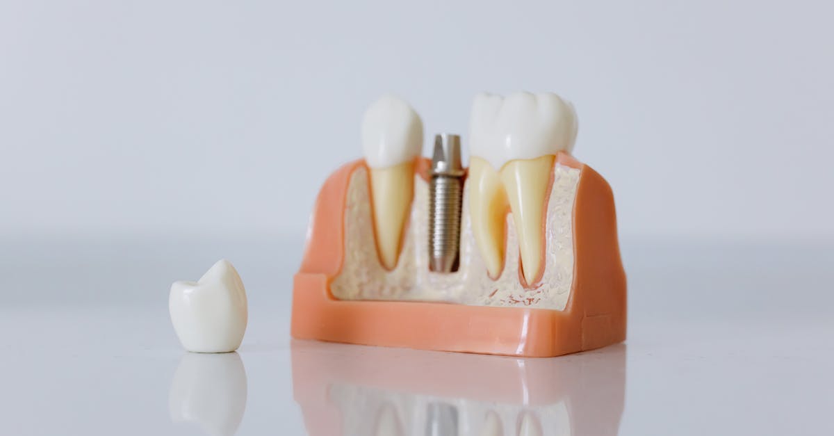 implant-tedavisi-acıtır-mı?-195.jpeg
