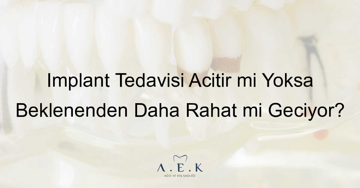 Implant Tedavisi Acitir Mi - AEK Dent