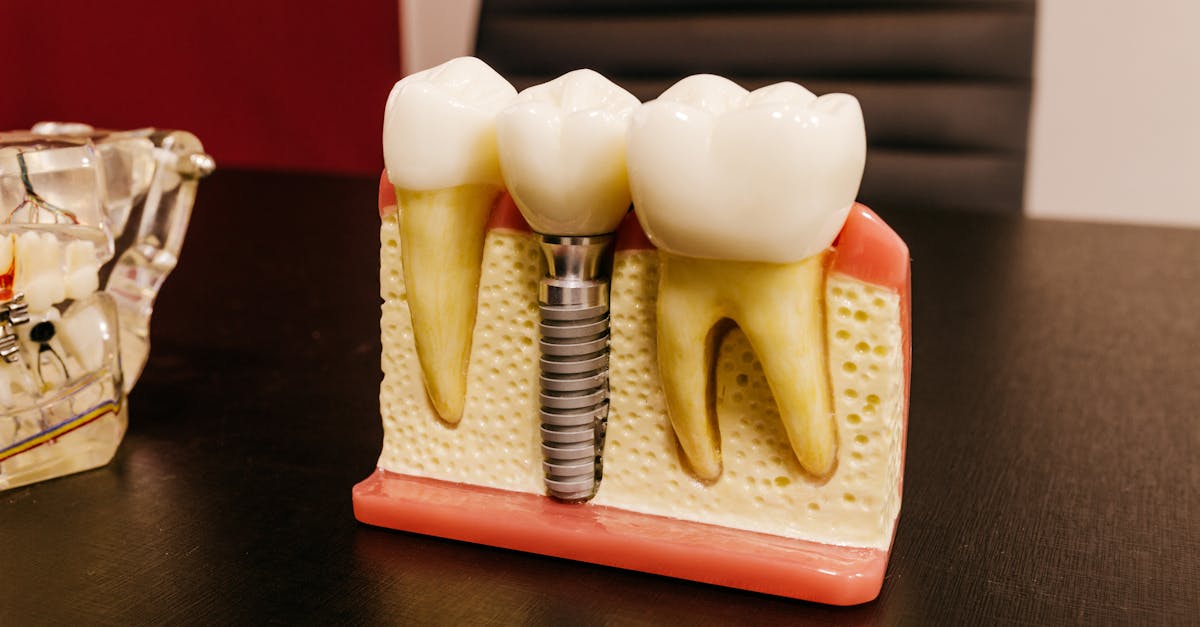 implant-tedavisi-acıtır-mı?-308.jpeg