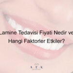 Lamine Tedavisi Fiyati Nedir - AEK Dent