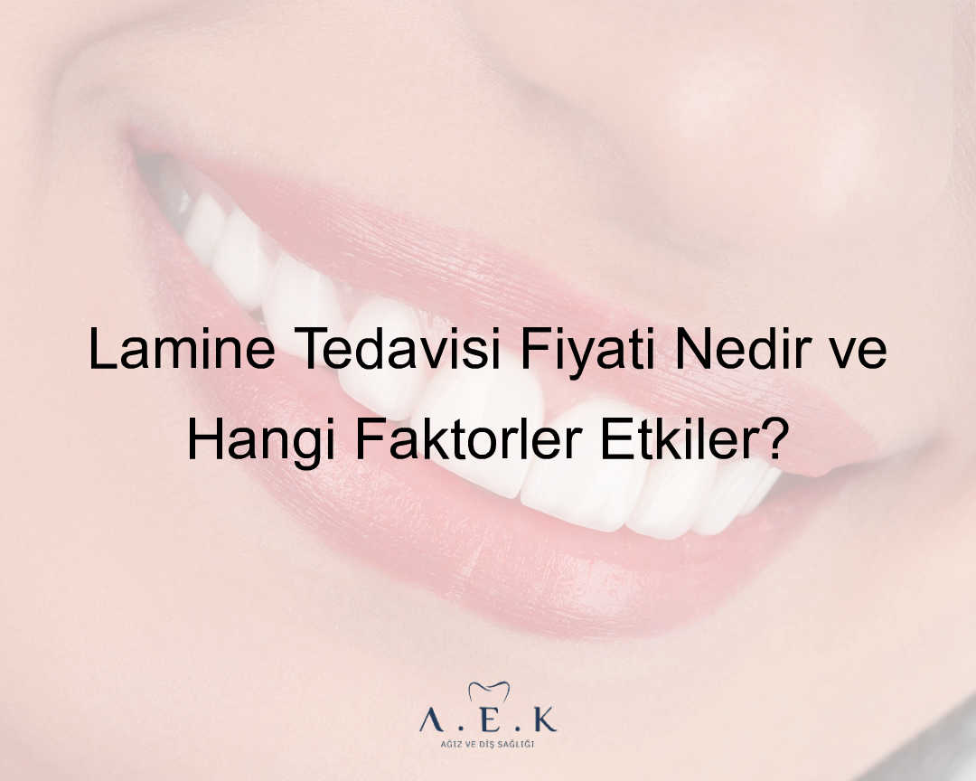 Lamine Tedavisi Fiyati Nedir - AEK Dent