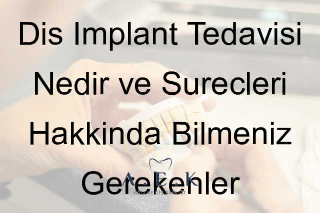 Implant Tedavisi Ve Surecleri - AEK Dent