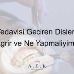 Kanal Tedavisi Olan Disin Agrimasi - AEK Dent