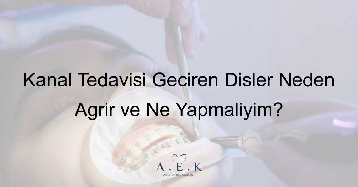 Kanal Tedavisi Olan Disin Agrimasi - AEK Dent