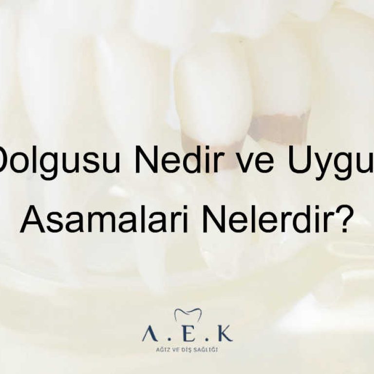 Diş Dolgusu Nedir Dolgu Nasil Yapilir - AEK Dent