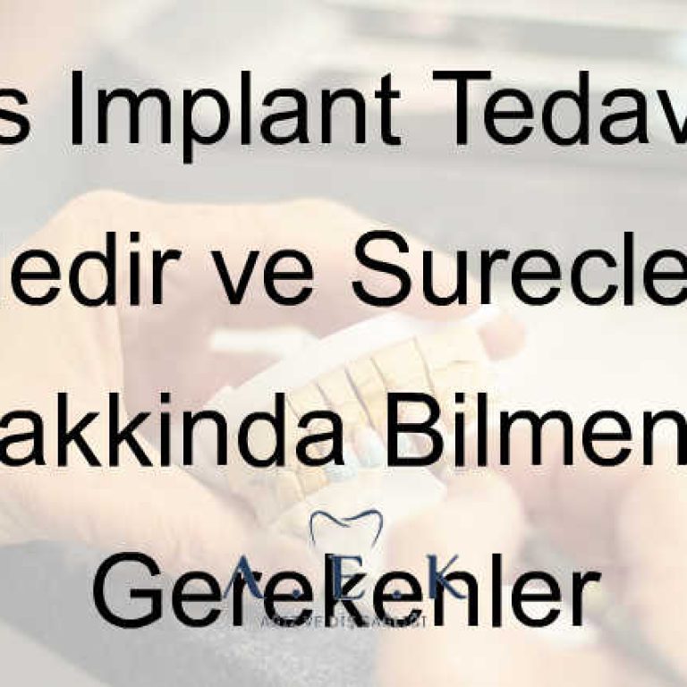 Implant Tedavisi Ve Surecleri - AEK Dent