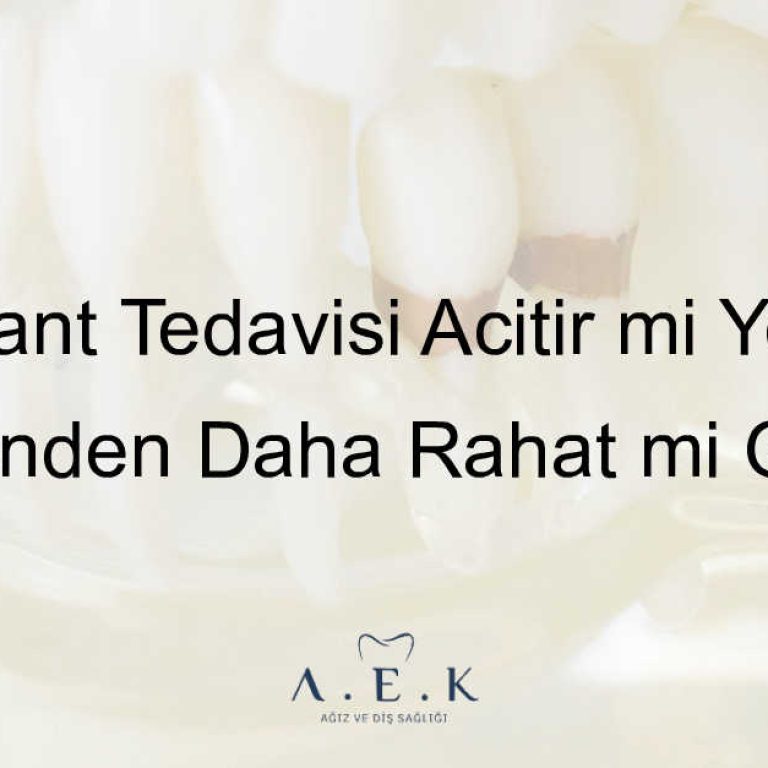 Implant Tedavisi Acitir Mi - AEK Dent